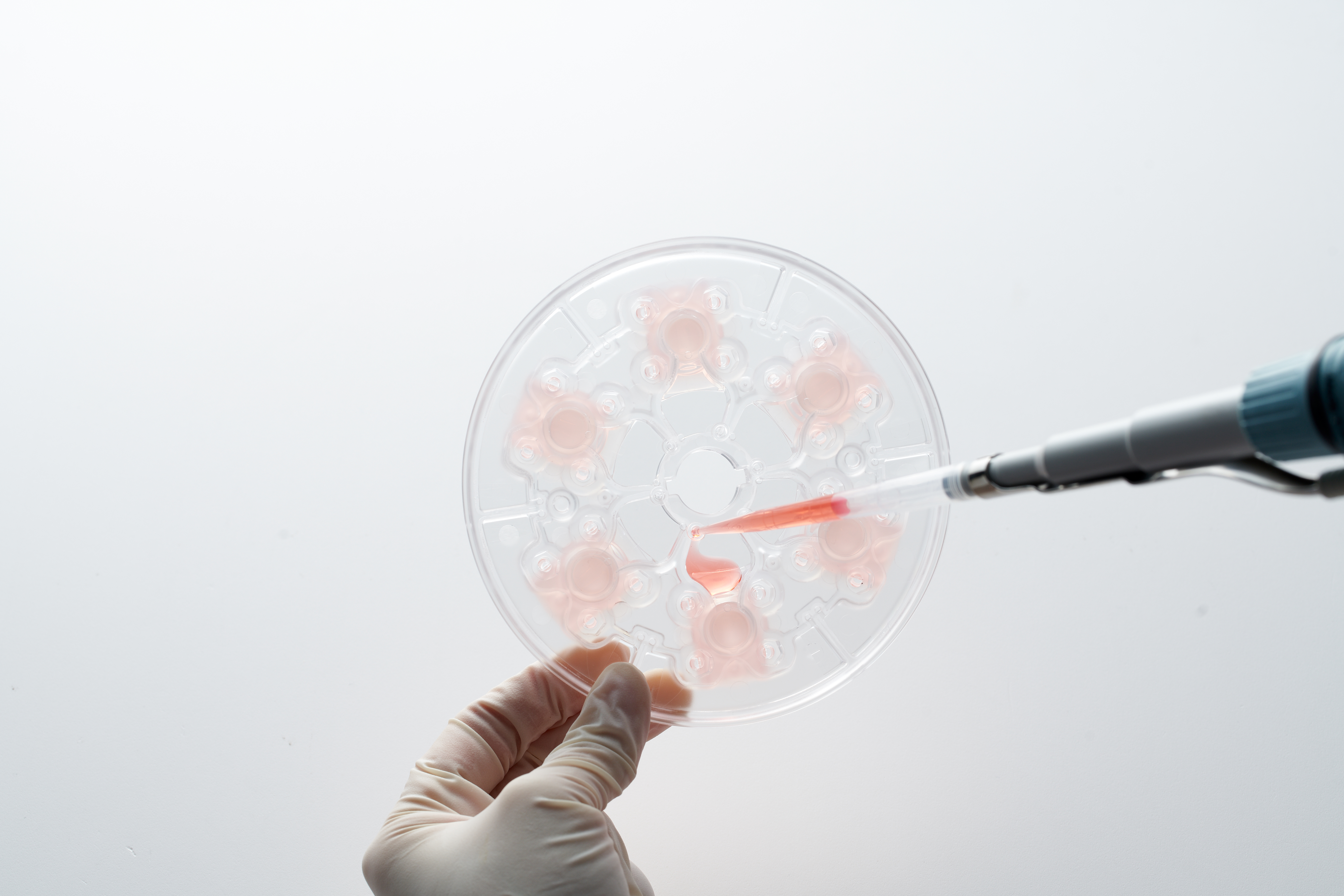 Researcher loading sample into ExoDisc cartridge with a pipette